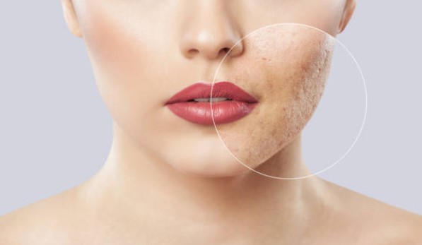 Las claves para conocer la piel atópica y cómo tratarla